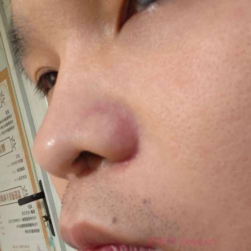 30岁岁江苏单身帅哥 - 毕节吉缘网